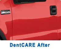 dentcare-after