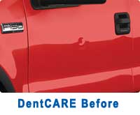 dentcare-before